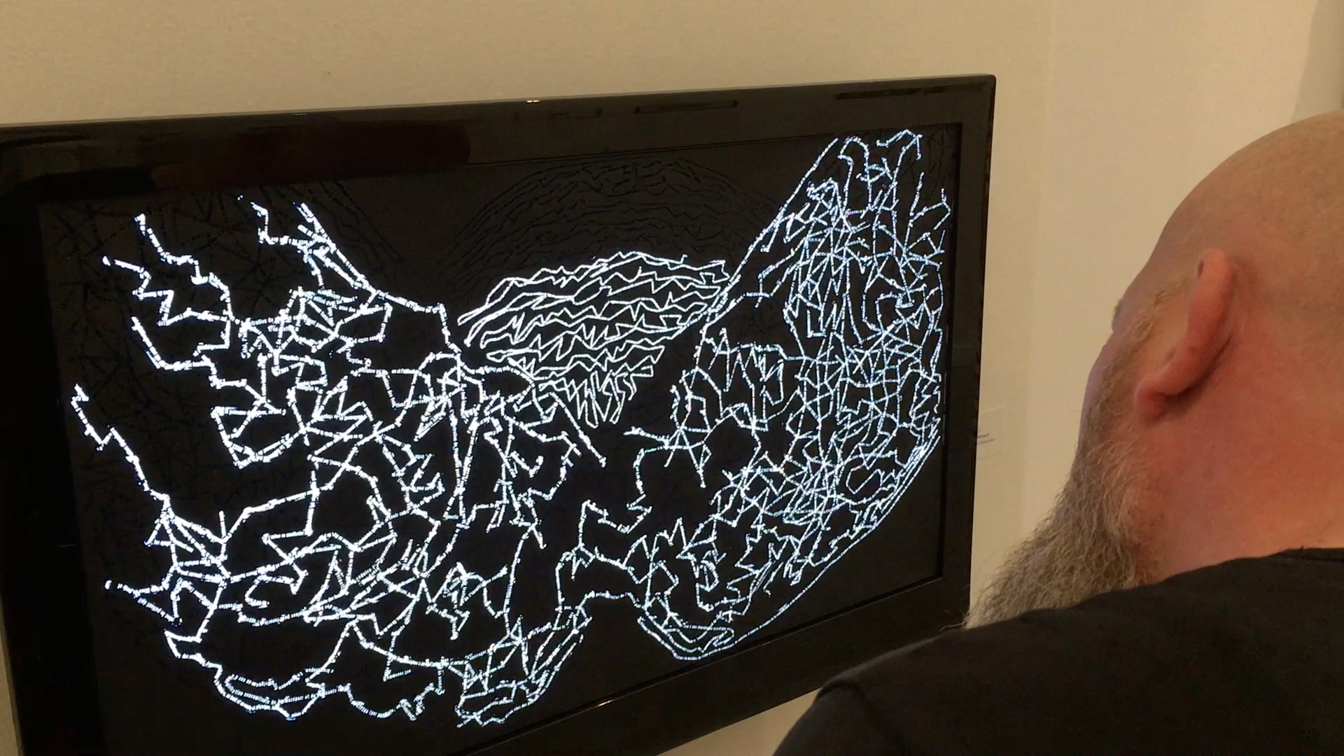 La Boverie, “La Leçon d’Anatomie, 500 ans d’histoire de la médecine”, Liège (B)